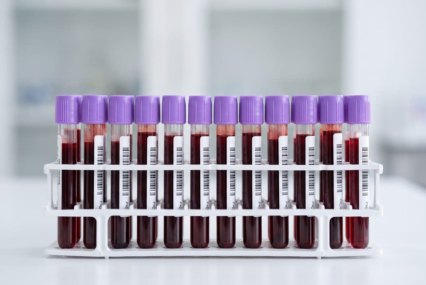 Buisjes met bloedmonsters voor diagnostisch bloedonderzoek bij Neo Clinics