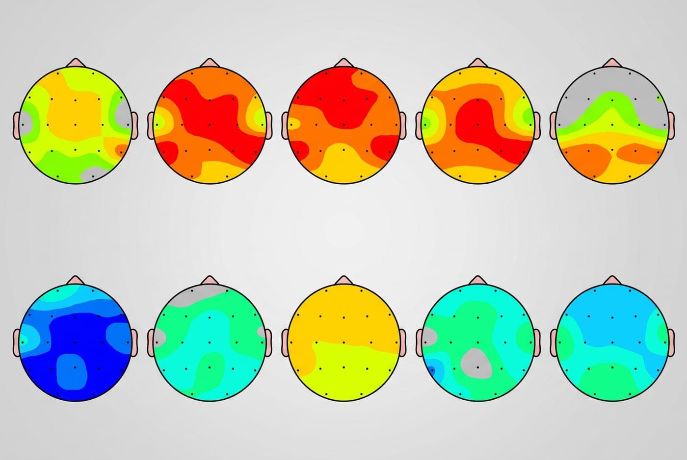 Topografische hersenkaarten uit een qEEG-hersenscan bij Neo Clinics